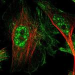 CTR2 Antibody in Immunocytochemistry (ICC/IF)