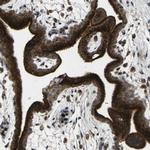 CTR2 Antibody in Immunohistochemistry (Paraffin) (IHC (P))