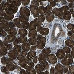 CTR2 Antibody in Immunohistochemistry (Paraffin) (IHC (P))