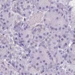 ASGR2 Antibody in Immunohistochemistry (Paraffin) (IHC (P))