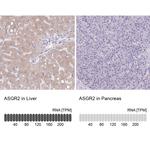 ASGR2 Antibody in Immunohistochemistry (IHC)