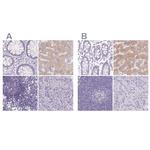 ASGR2 Antibody in Immunohistochemistry (IHC)