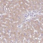 ASGR2 Antibody in Immunohistochemistry (IHC)