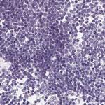 ASGR2 Antibody in Immunohistochemistry (IHC)