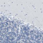 ASIC5 Antibody in Immunohistochemistry (Paraffin) (IHC (P))