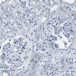 ASIC5 Antibody in Immunohistochemistry (Paraffin) (IHC (P))