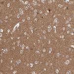 LPHN3 Antibody in Immunohistochemistry (Paraffin) (IHC (P))