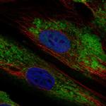 ARID5B Antibody in Immunocytochemistry (ICC/IF)