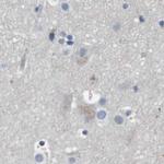 MOSC2 Antibody in Immunohistochemistry (IHC)