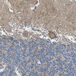 PTPRZ Antibody in Immunohistochemistry (IHC)