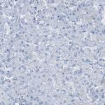 PTPRZ Antibody in Immunohistochemistry (IHC)