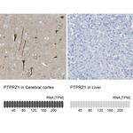 PTPRZ Antibody