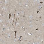 PTPRZ Antibody in Immunohistochemistry (IHC)