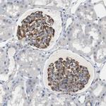 ADCY10 Antibody in Immunohistochemistry (Paraffin) (IHC (P))