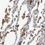 ADCY10 Antibody in Immunohistochemistry (Paraffin) (IHC (P))