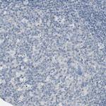 ADCY10 Antibody in Immunohistochemistry (Paraffin) (IHC (P))