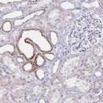 Aquaporin 6 Antibody in Immunohistochemistry (Paraffin) (IHC (P))