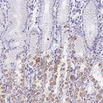 Aquaporin 6 Antibody in Immunohistochemistry (Paraffin) (IHC (P))