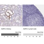 Aquaporin 6 Antibody in Immunohistochemistry (IHC)