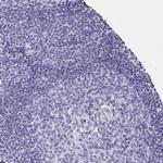 Aquaporin 6 Antibody in Immunohistochemistry (IHC)