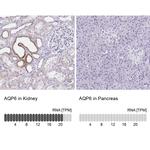 Aquaporin 6 Antibody