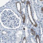 TULP3 Antibody in Immunohistochemistry (Paraffin) (IHC (P))