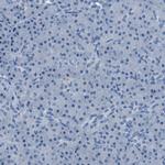 TULP3 Antibody in Immunohistochemistry (Paraffin) (IHC (P))