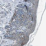 TULP3 Antibody in Immunohistochemistry (Paraffin) (IHC (P))