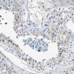 TULP3 Antibody in Immunohistochemistry (Paraffin) (IHC (P))