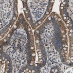 HADHA Antibody in Immunohistochemistry (IHC)