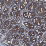 JWA Antibody in Immunohistochemistry (Paraffin) (IHC (P))