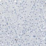 WNK2 Antibody in Immunohistochemistry (IHC)