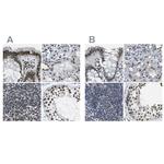 NSRP1 Antibody in Immunohistochemistry (IHC)