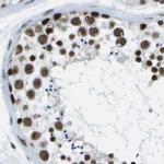 NSRP1 Antibody in Immunohistochemistry (IHC)