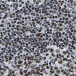 NSRP1 Antibody in Immunohistochemistry (IHC)