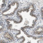 ACBD3 Antibody in Immunohistochemistry (Paraffin) (IHC (P))