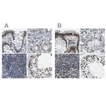 NSRP1 Antibody in Immunohistochemistry (IHC)