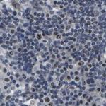 NSRP1 Antibody in Immunohistochemistry (IHC)