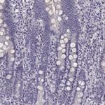 Kiaa0319 Antibody in Immunohistochemistry (IHC)