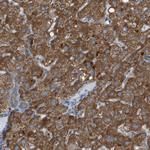 C1GALT1C1 Antibody in Immunohistochemistry (Paraffin) (IHC (P))