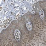 KANK2 Antibody in Immunohistochemistry (Paraffin) (IHC (P))