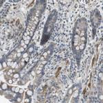 KANK2 Antibody in Immunohistochemistry (Paraffin) (IHC (P))