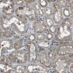 KANK2 Antibody in Immunohistochemistry (Paraffin) (IHC (P))