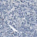 RTN3 Antibody in Immunohistochemistry (IHC)