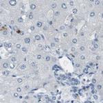 RTN3 Antibody in Immunohistochemistry (IHC)