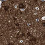 RTN3 Antibody in Immunohistochemistry (IHC)