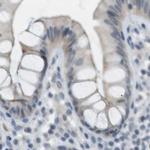 RTN3 Antibody in Immunohistochemistry (IHC)