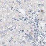 RTN3 Antibody in Immunohistochemistry (IHC)