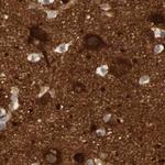 RTN3 Antibody in Immunohistochemistry (IHC)