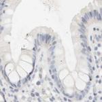 RTN3 Antibody in Immunohistochemistry (IHC)